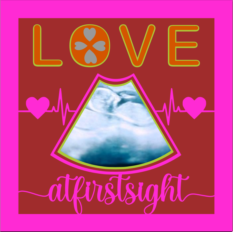 Love at First Sight SVG | Baby Ultrasound Keepsake Design