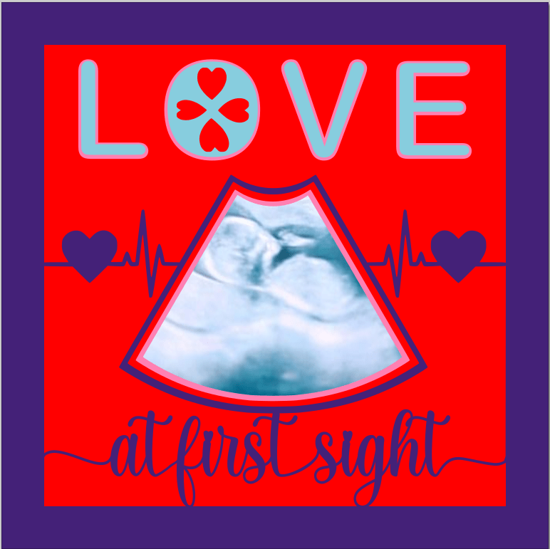 Love at First Sight SVG | Baby Ultrasound Keepsake Design