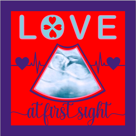 Love at First Sight SVG | Baby Ultrasound Keepsake Design